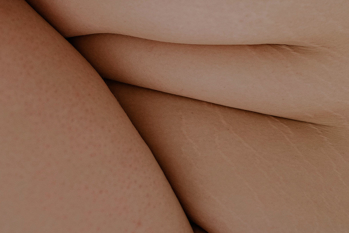 What is Endometriosis?