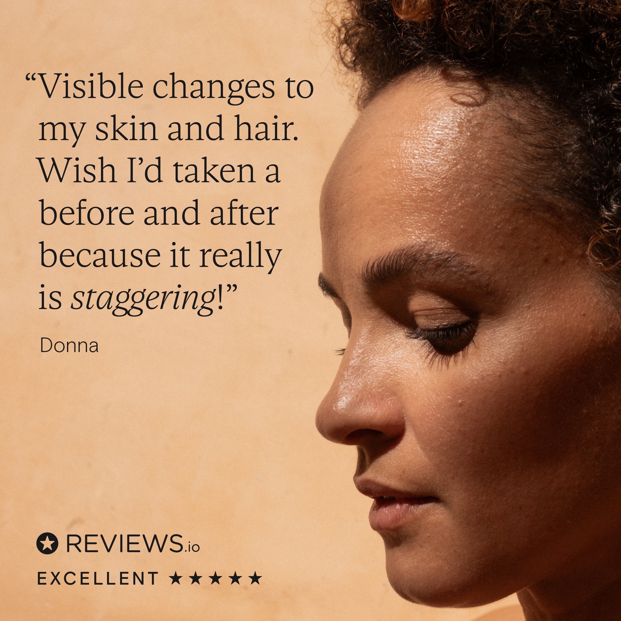 Customer testimonial highlighting visible skin and hair changes after using collagen supplements.
